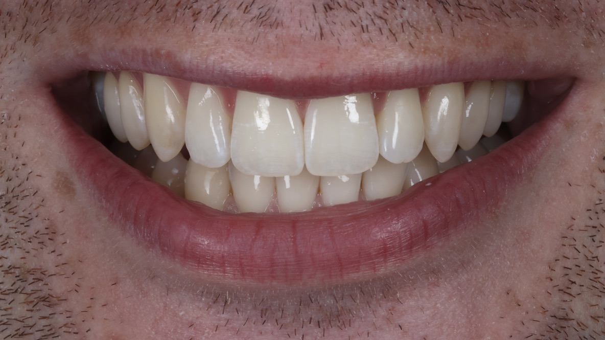 A. Green after orthodontics treatment with Dr Jack Dowling