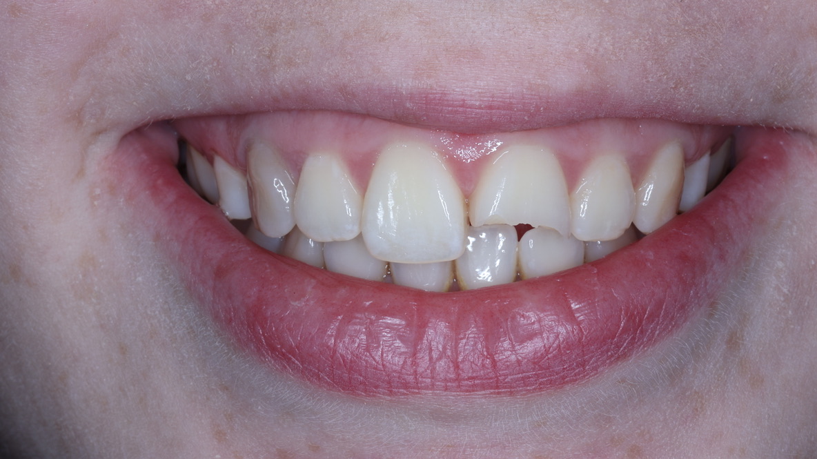 Before — C. Sey, trauma repair