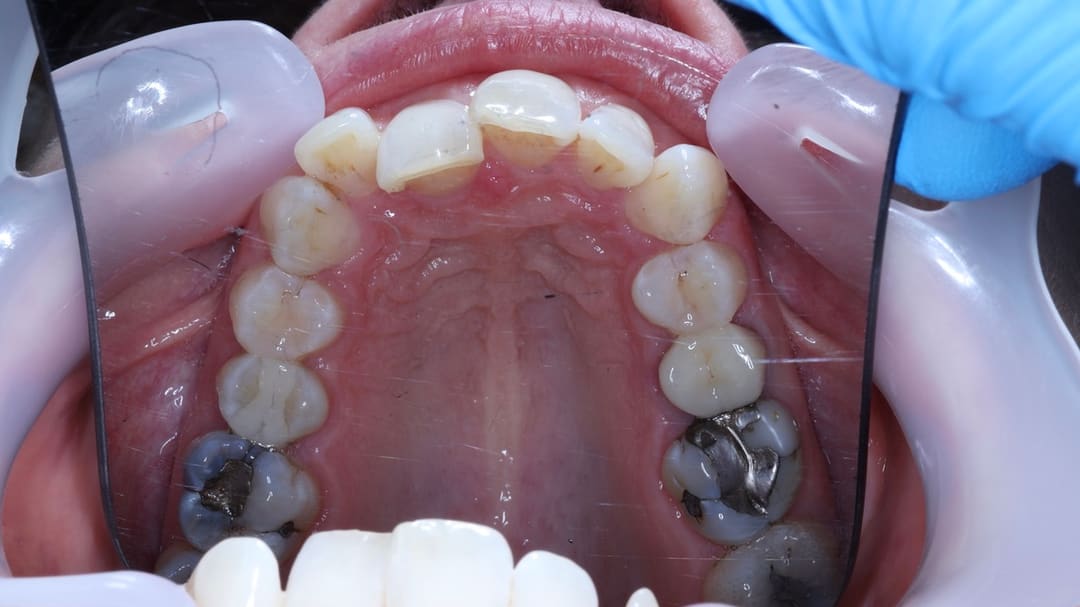 Before — patient R, orthodontics