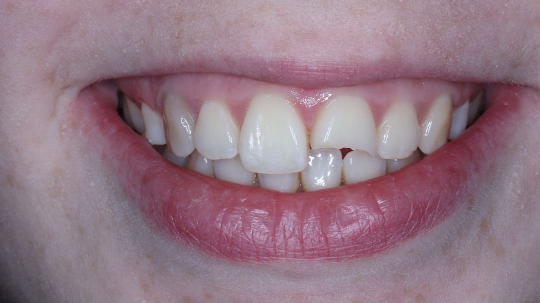 Before — patient SC, trauma repair